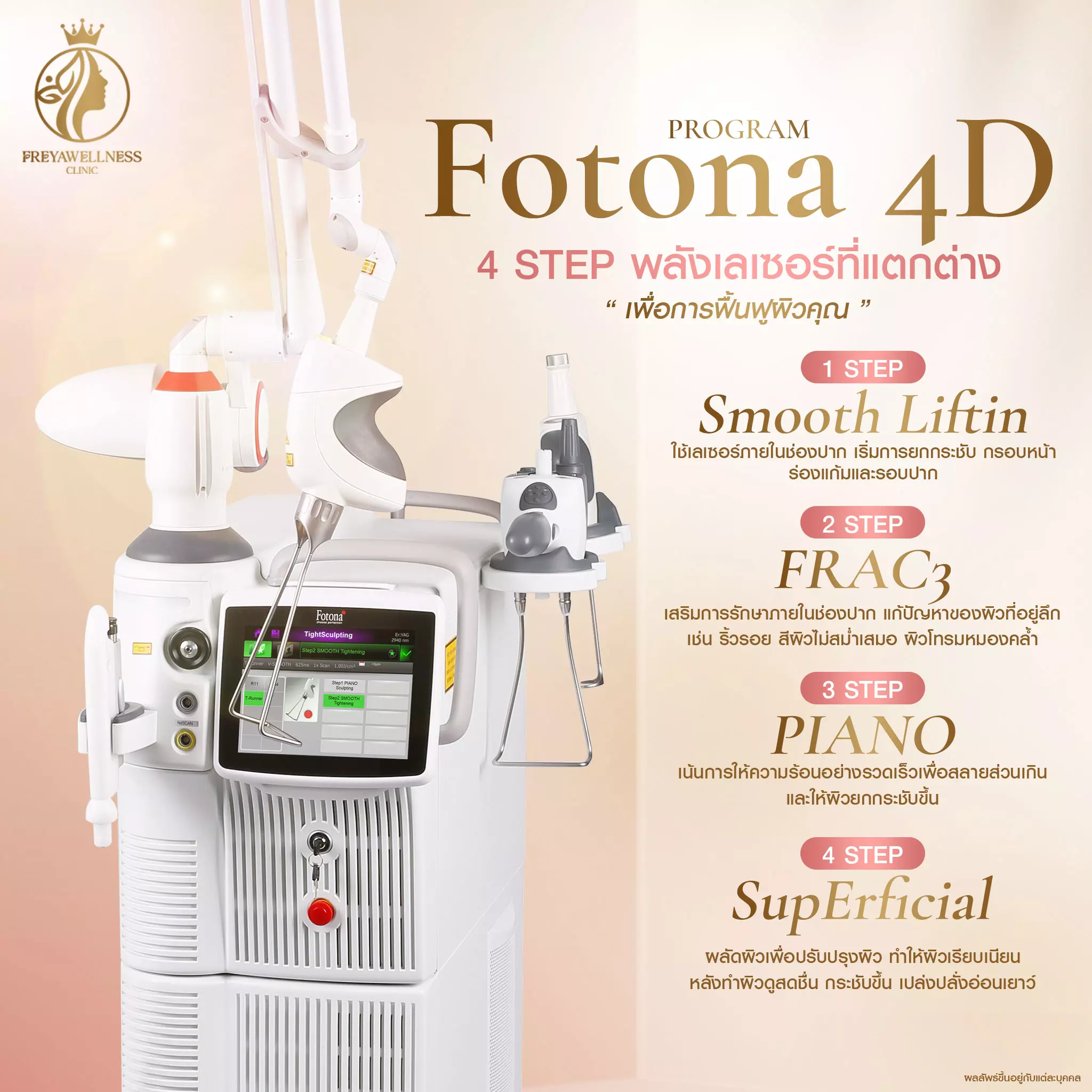 Freya-Fotona4D
