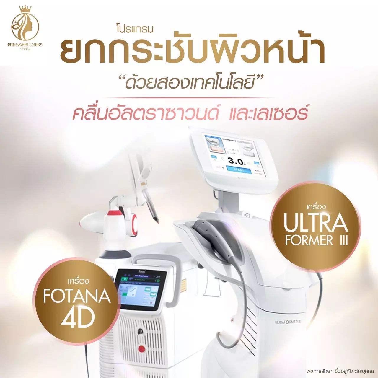 Freya Ultraformer and Fotona4d